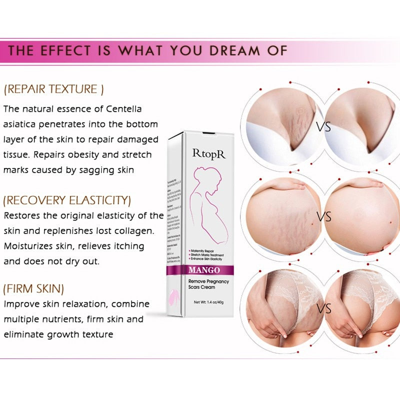 Firming Body Cream Helps to Diminish Stretch Marks and Scars - Mango