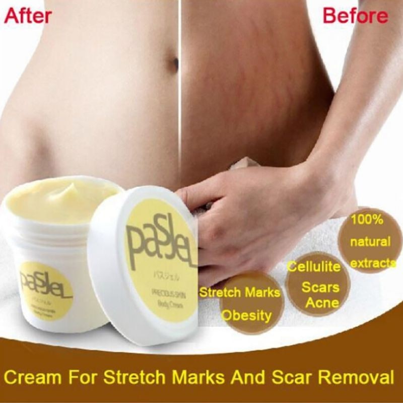 PasJel Stretch Mark and Scar Diminishing Body Cream - 1 Jar