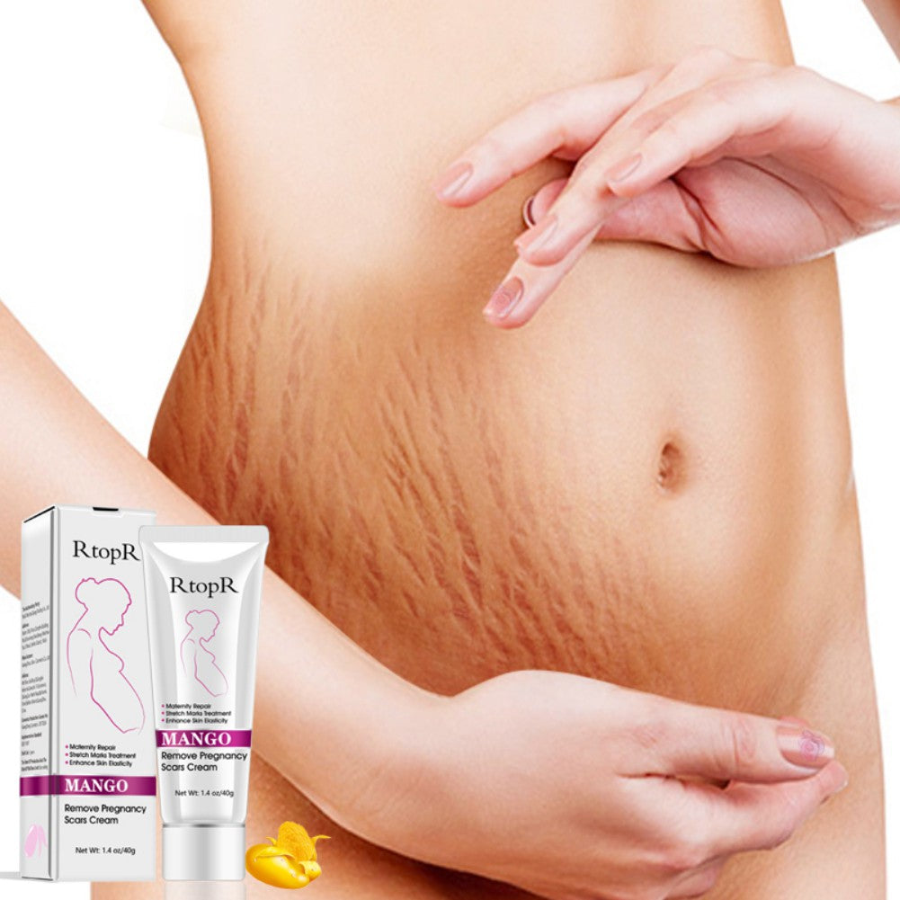 Firming Body Cream Helps to Diminish Stretch Marks and Scars - Mango