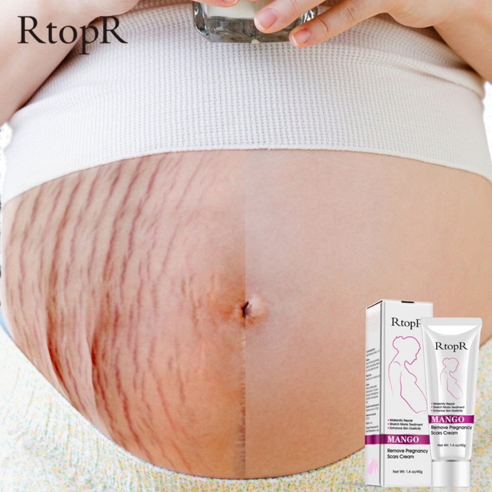 Firming Body Cream Helps to Diminish Stretch Marks and Scars - Mango