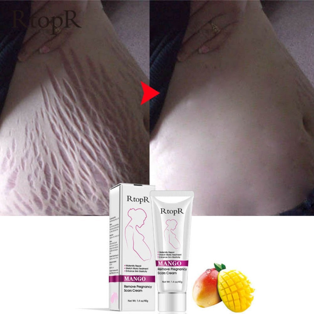Firming Body Cream Helps to Diminish Stretch Marks and Scars - Mango