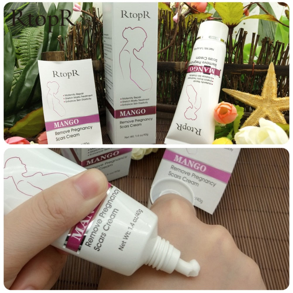 Firming Body Cream Helps to Diminish Stretch Marks and Scars - Mango